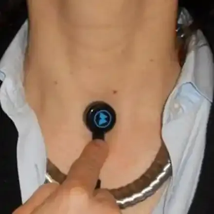 Immagine rappresentativa della laringectomia